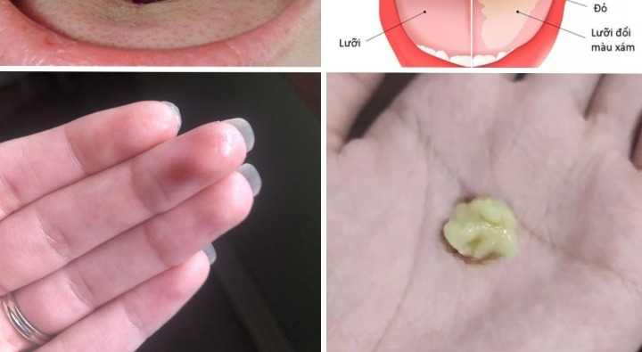 Here’s What You Need To Know Ab