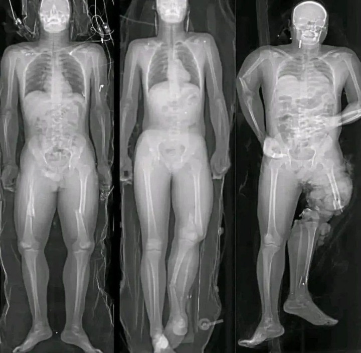 What you should know if you got the COVID vaccine: The truth behind these viral messages.