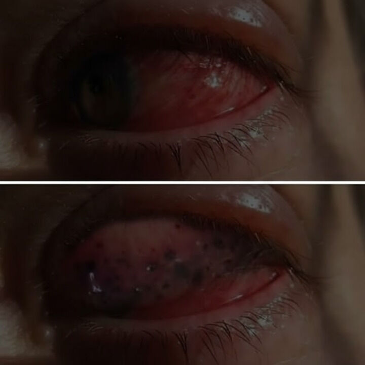 The Real Consequences of Sleeping With…