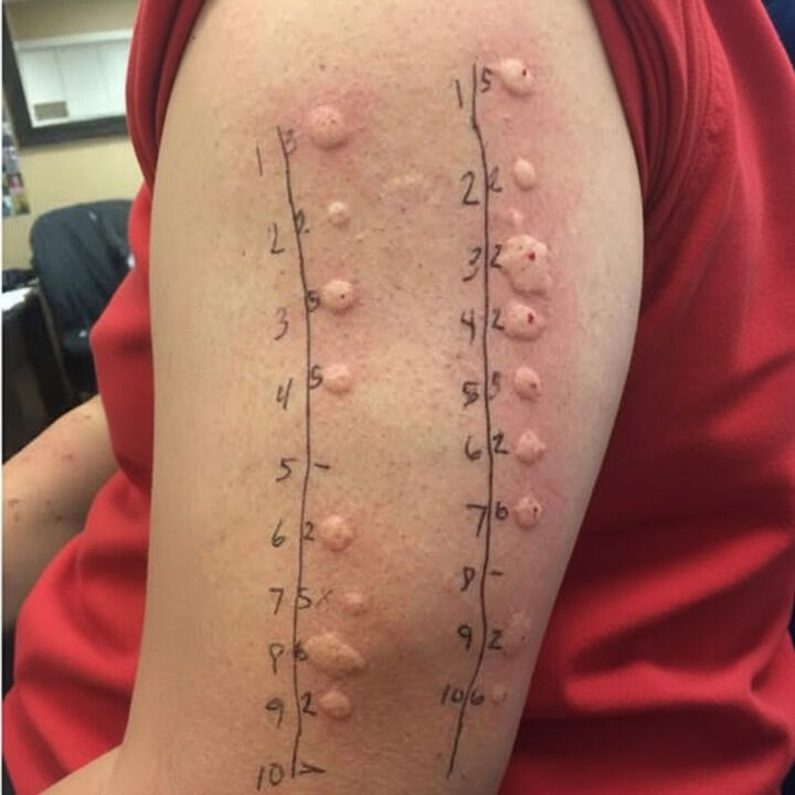 These are the consequences of sleeping with the… See more