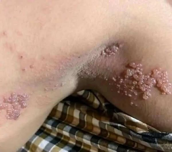 These are the consequences of sleeping co – See now!