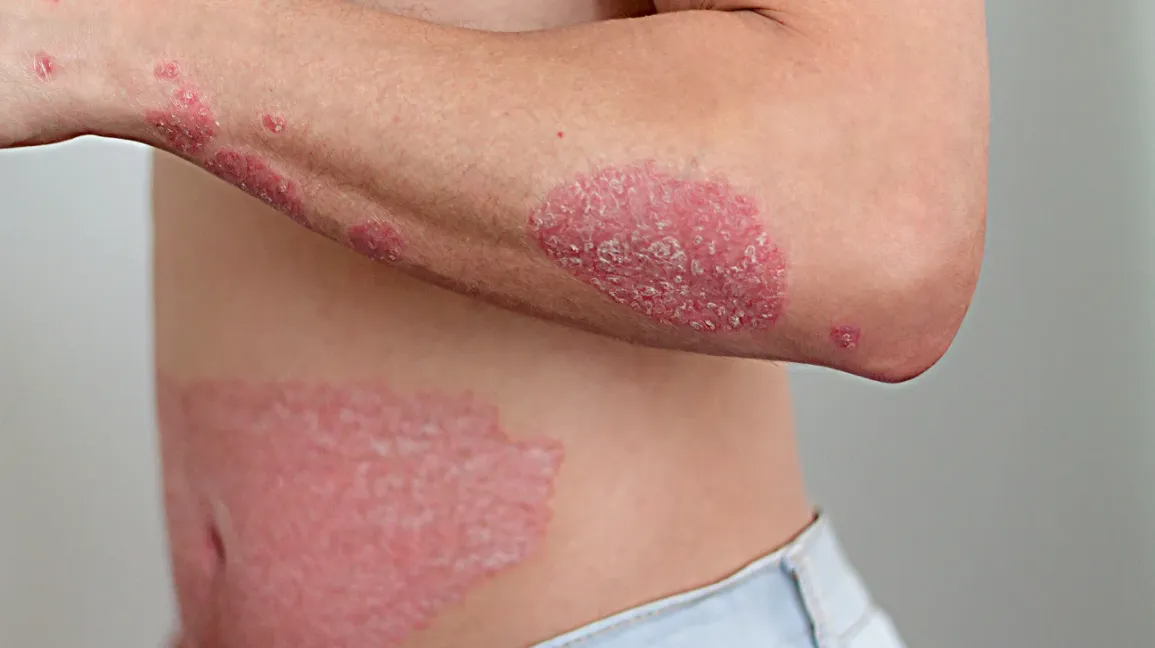 We Thought It Was an Allergy: How a Simple Itch Changed Everything