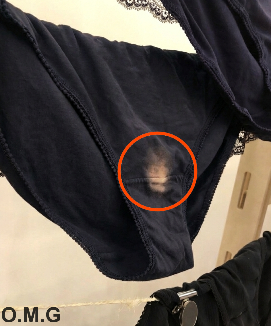 If You See A ‘Bleach’ Patch On Your Underwear, Here’s What It Means. See more