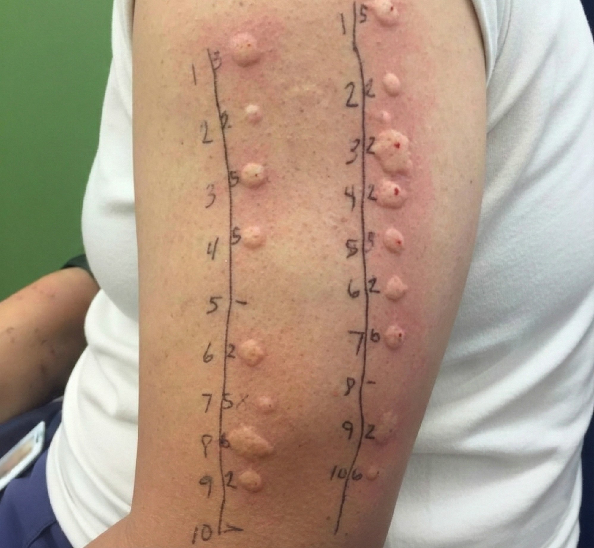 These are the consequences of sleeping with the…