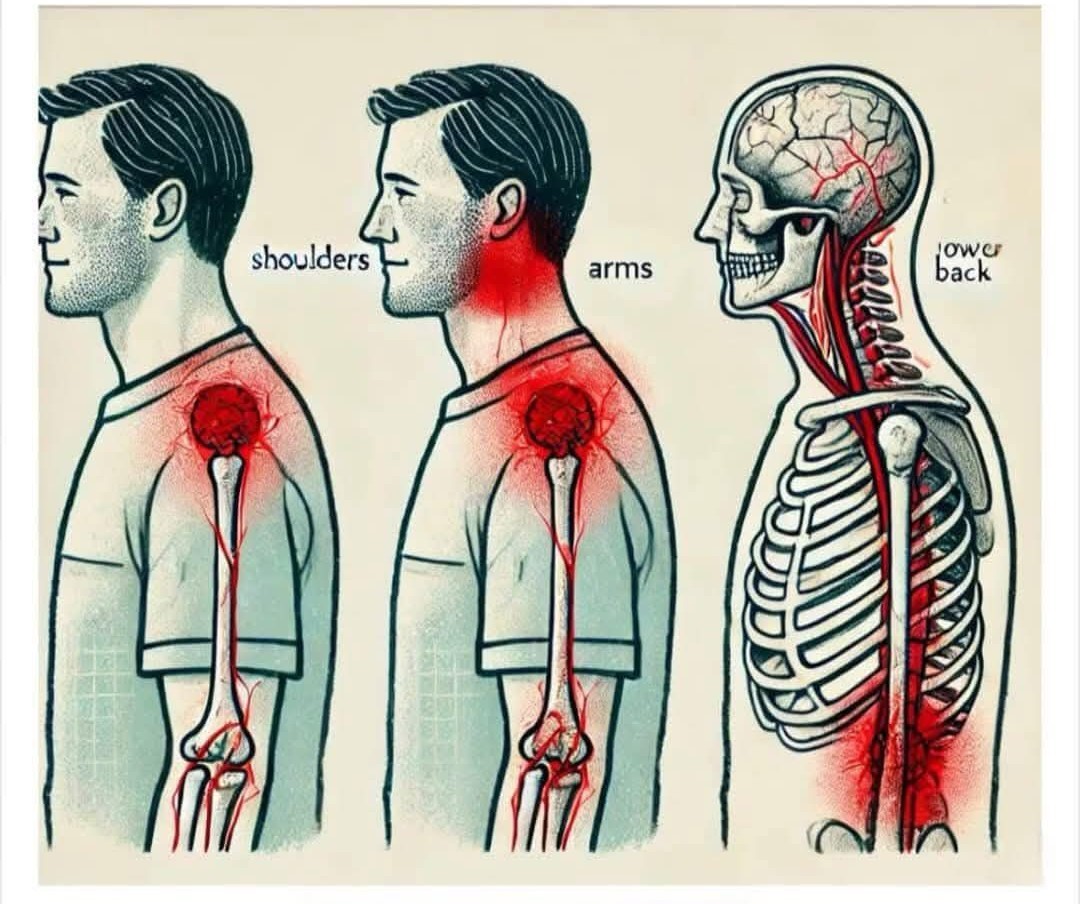 Polymyalgia Rheumatica: Key Symptoms and Indicators​