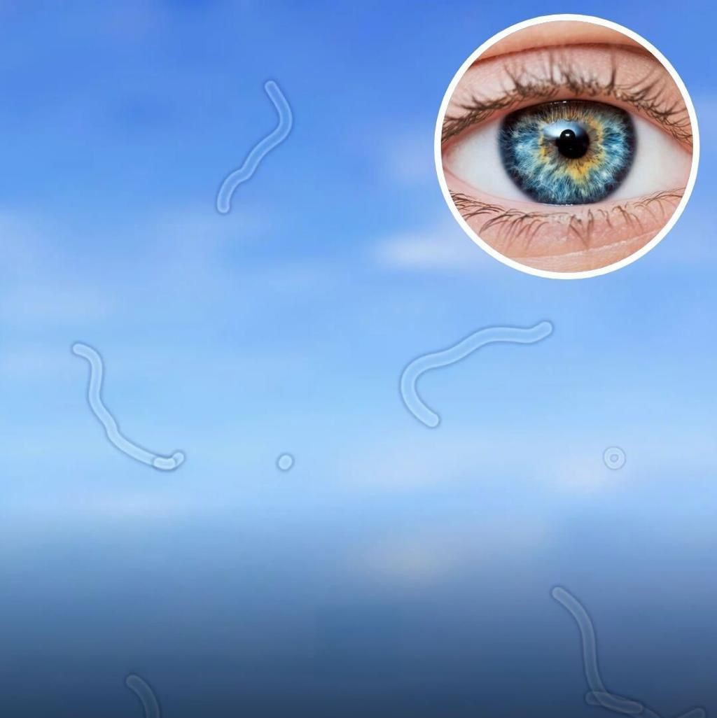What Are Eye Floaters? Here What To Do If you Start Seeing Them, According to an Eye Doctor