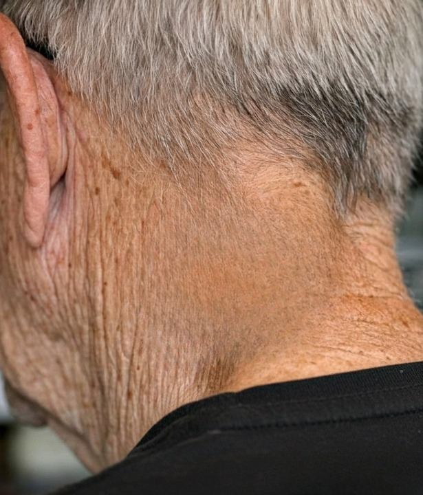 BE CAREFUL, if you get these bumps on your body, it means you have ca…