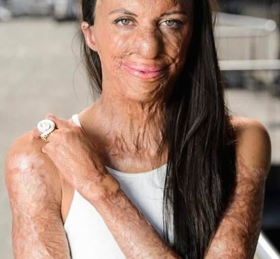 These are the consequences of sleeping with pe… See more